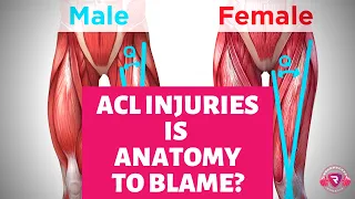 ACL Injuries:  Is Female Anatomy to Blame ?