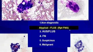 Thyroid Cytology I: Approach