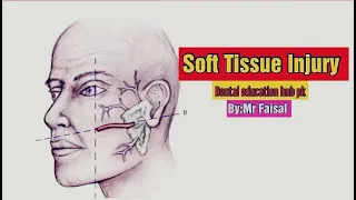 Soft Tissue Trauma/Injuries/ Maxillofacial Trauma/ Maxillofacial Emergencies