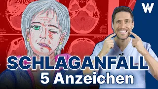 Plötzlicher Schlaganfall: Diese Anzeichen solltest Du kennen & damit Leben retten | Time is Brain!