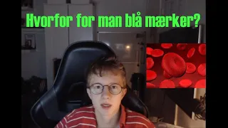 Hvorfor for man blå mærker?