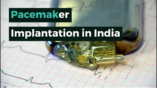 Pacemaker Implantation in India, Pacemaker Implantation Cost in India