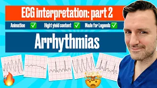 Interpretazione ECG per principianti: Parte 2 - Aritmie 🔥🔥🔥🔥 animazione, criteri e spiegazione