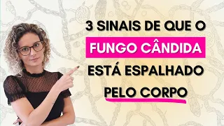 3 sinais de que o fungo Cândida está espalhado pelo seu corpo