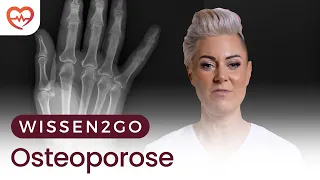 OSTEOPOROSE I DOC CARO