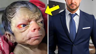 He got Abandoned by his Parents, Because Of His Looks. Years Later He Pays Them A SHOCKING Visit