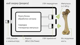 Эхоостеометр Орлов Матвей Ты-Инноватор 2020