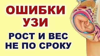 Узи во время беременности. Почему ошибки в весе и росте ребенка? Патологии на УЗИ у беременных.