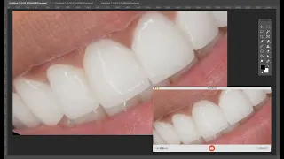 𝘝𝘪𝘳𝘵𝘶𝘢𝘭 𝘋𝘦𝘯𝘵𝘪𝘴𝘵 🦷 | Perfect teeth combo subliminal (forced) ☾