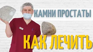 Камни простаты | Как избавиться от калькулёзного простатита |