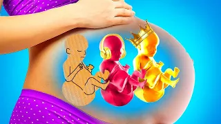 EMBARAZO DE RICOS VS EMBARAZO DE POBRES || Situaciones Y Momentos Divertidos Durante El Embarazo