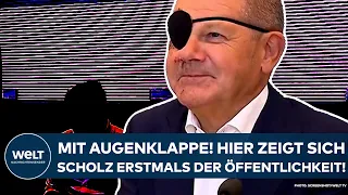 OLAF SCHOLZ: Mit Augenklappe! Hier zeigt sich der Kanzler zum ersten Mal der Öffentlichkeit