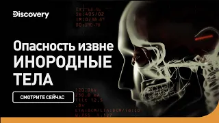 Опасность извне | Инородные тела | Discovery