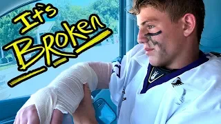 How I broke my arm