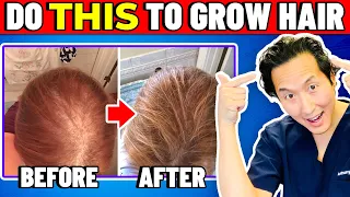 How to Treat Thinning Hair The Holistic Way!