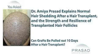 Why Hair Grafts are so Strong they Can't Fall Out, & Normal Hair Shedding after a Hair Transplant