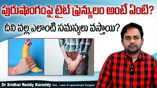 How to Deal With Tight Frenulum? || Tight Foreskin Treatment in Telugu || Treatment Range Hospital