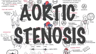 Aortic Stenosis - Overview (signs and symptoms, pathophysiology, treatment)
