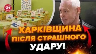 🔴ЖАХЛИВА доба для Харківщини! НОВІ дані про стан ДІТЕЙ після обстрілу РФ. Відомі НАСЛІДКИ руйнувань