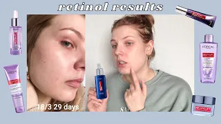 Over 30 Days Of Retinol, L'Oréal Revitalift Skincare Review | heidismakeup