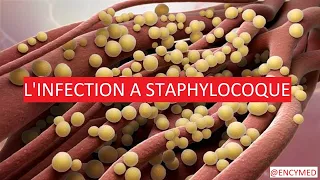 L'INFECTION A STAPHYLOCOQUE