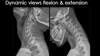 Imaging of normal Spine physio Nov 2014   Dr Mamdouh Mahfouz In Arabic