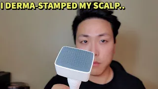 I USED A DERMA STAMP FOR HAIR GROWTH AND THIS IS WHAT I THOUGHT OF IT..