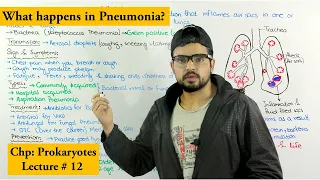 Pneumonia disease | Causes, Symptoms, Transmission, prevention and treatment |