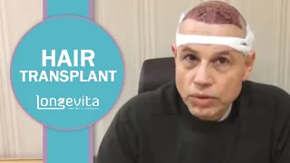 Haartransplantation in Istanbul | Longevita
