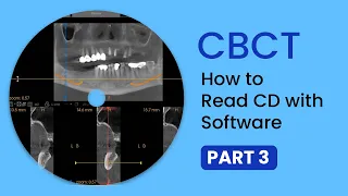CBCT Part 3- How to read #cbct on Dental Software for implant planning and diagnosis making
