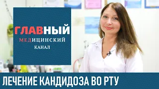 Быстрое Лечение Кандидоза во Рту у ребенка и взрослых. Лечение молочницы ротовой полости