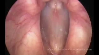 Video Stroboscopy of Vocal Cords