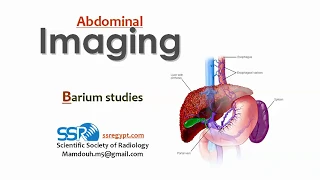 4 Barium Studies (oseophagus) -  Prof.Mamdouh mahfouz (2019 edition)