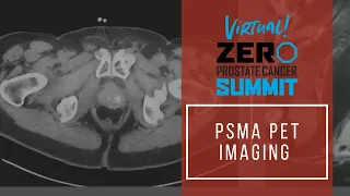 PSMA PET Imaging - Summit 2021