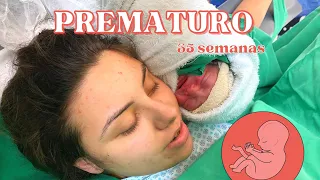 PARTO PREMATURO PELO SUS - MEU RELATO COM 35 SEMANAS | CESAREA DE EMERGENCIA