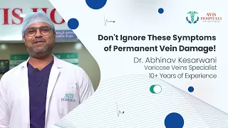 Painless Varicose Veins Treatment | Dr. Abhinav Kesarwani Specialist at Avis Hospitals