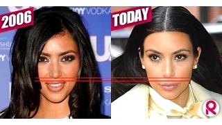 How To Look Younger - One Weird Trick // Do Your Lips Make You Look Older?