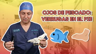 Ojo de pescado