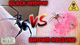 WHICH BITE IS WORSE? Black WIDOW VS Brown RECLUSE!