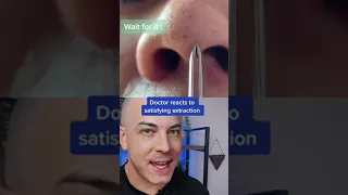 Doctor reacts to extremely satisfying pimple pop! #usegloves #dermreacts #pimplepop #pimplepopper