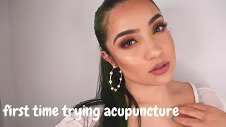 First time EVER trying ACUPUNCTURE! | KissedByKen