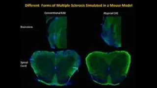 Multiple Sclerosis Research and Clinic Update