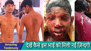 Watch Amazing Healing Testimony | Jesus Give Him New Life | Ankur Narula Ministry Big Testimony