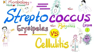 Erysipelas vs Cellulitis | Group A ß-hemolytic Streptococcus | Microbiology 🧫 & Infectious Diseases🦠