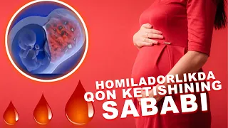 HOMILADORLIKDA QON KETISHINING SABABI | ХОМИЛАДОРЛИКДА КОН КЕТИШИНИНГ САБАБИ