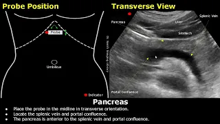 Pancreas Ultrasound Probe Positioning | Transducer Placement & Scanning | Abdominal USG | Sonography