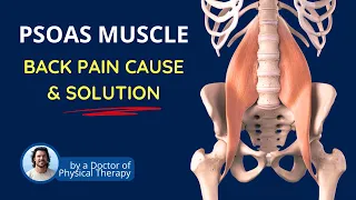 Psoas Muscle - Pelvic Tilt & Hip Flexion | Back Pain Fix