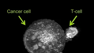 Label-free Live Cell Imaging: Activated T-Cell Killing Cancer Cell