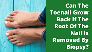 Can The Toenail Grow Back If The Root Of The Nail Is Removed By Biopsy?