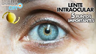 Lente Intraocular 🔍 5 Puntos Que Debes Conocer 👁👁💡